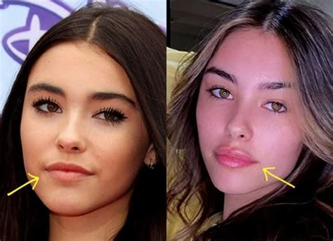 Madison Beer shows “proof” she didn’t have plastic surgery after。